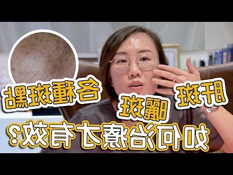 臉上長班