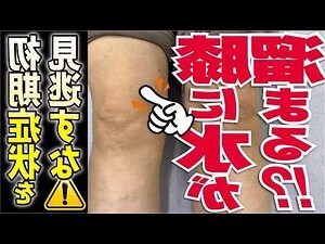 水鍾效應