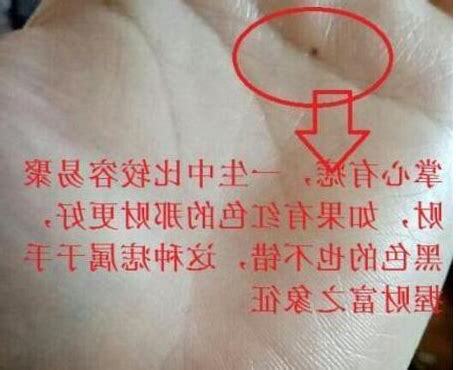 虎心有痣