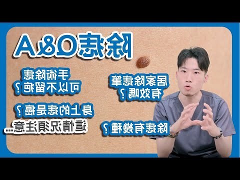 痣凸出來
