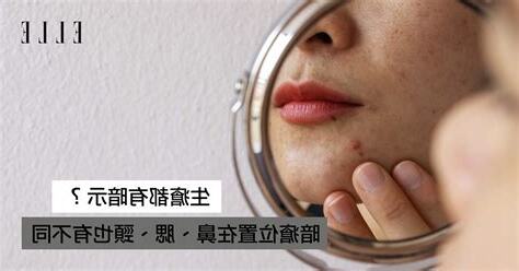 生暗瘡解決