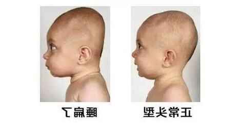 後腦勺凹凸不平