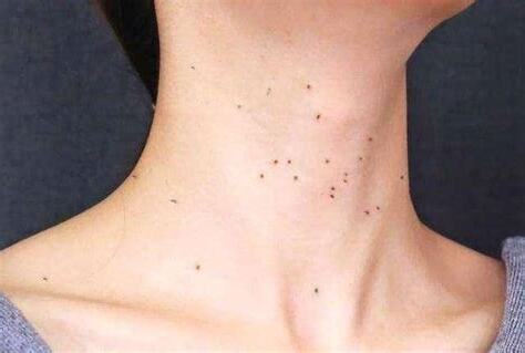 前脖子正中間有痣