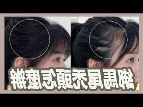 綁馬尾旁邊禿