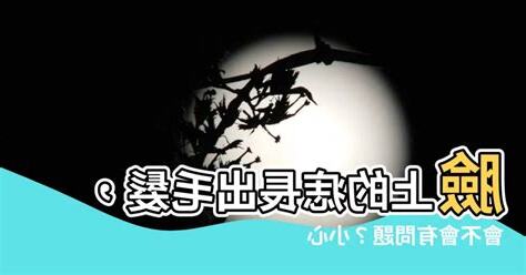 臉上痣長毛