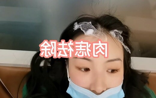 頭上有肉痣