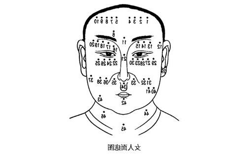 宜夫痣