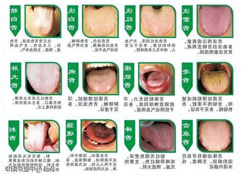舌頭長痣看哪一科