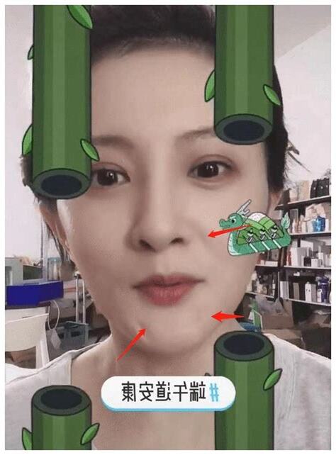 下巴凹陷面相