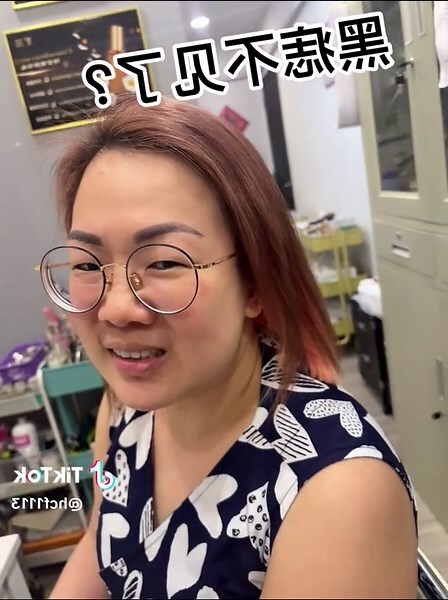 面部黑痣