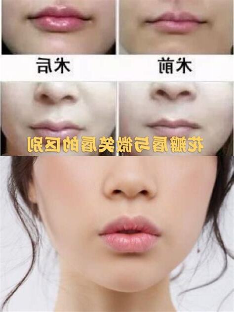 花瓣唇面相