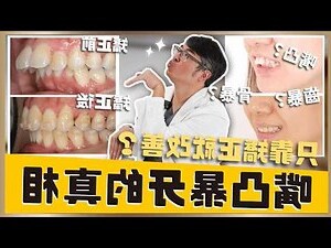 人有多少牙齒
