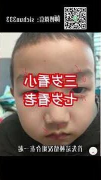 小孩面相