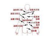 右腋下有痣代表什麼