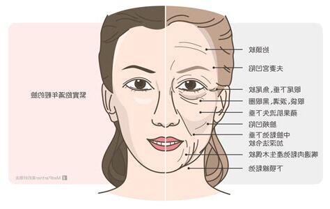 臉部皺紋面相