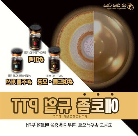 壁虎會爬到人身上嗎ptt