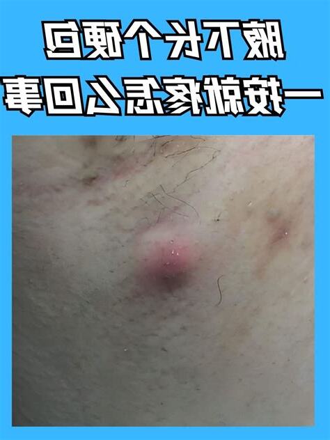 腋下流血