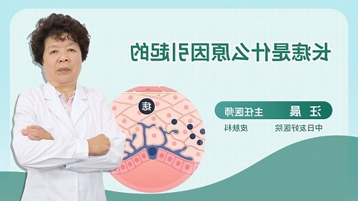 多痣的原因