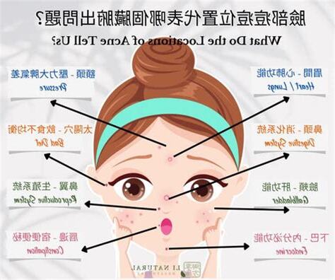 痘痘位置代表什麼