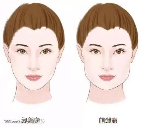 改變臉型