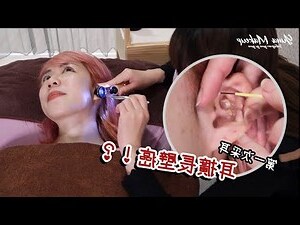 耳朵痕癢