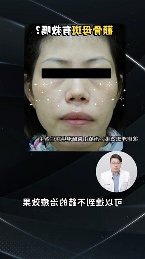 斑點人