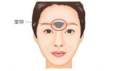 印堂發黑怎麼看