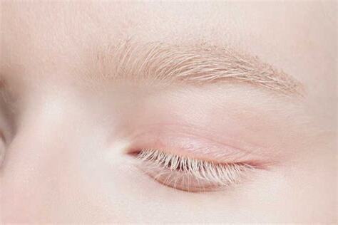 右邊眉毛長白毛