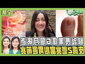 右腳踝有痣