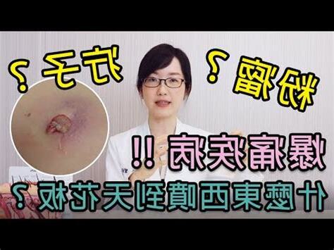 釘子是什麼