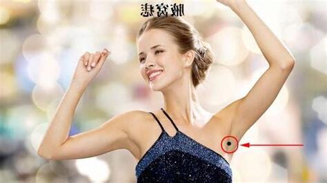 右腋下有痣