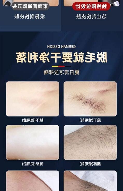 男性阴毛
