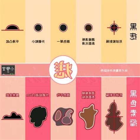 為甚麼會長痣
