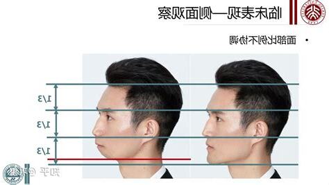 沒有下巴的人