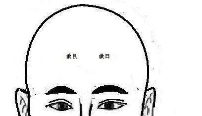 額骨隆起