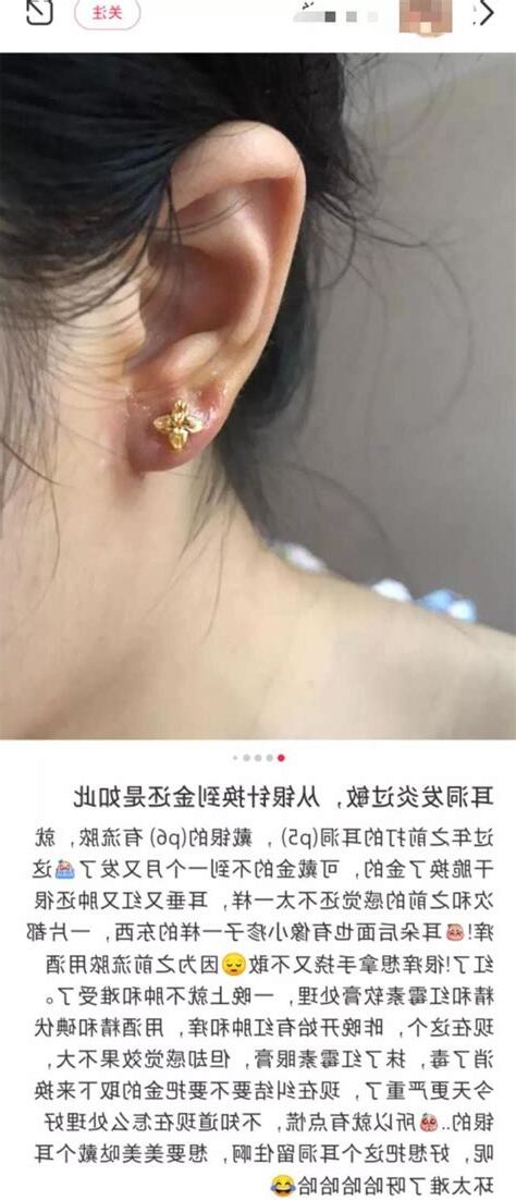 打耳洞會漏財嗎