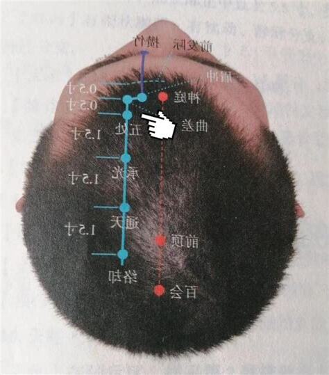 五處穴
