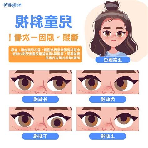 鬥雞眼面相