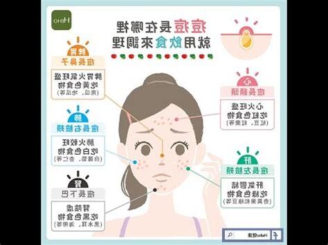 人中暗瘡面相