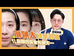 笑起來眼袋很大