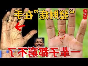 守門有痣