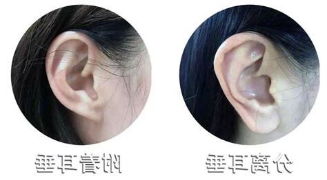 耳垂翹起來