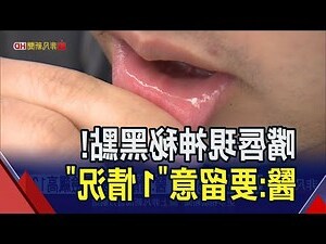 下嘴唇有黑斑
