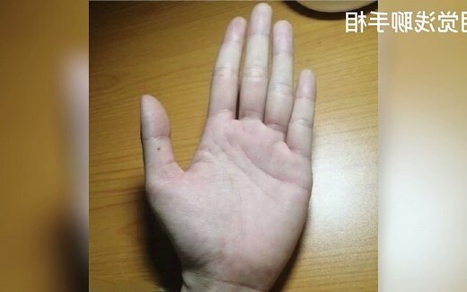大拇指突然长痣