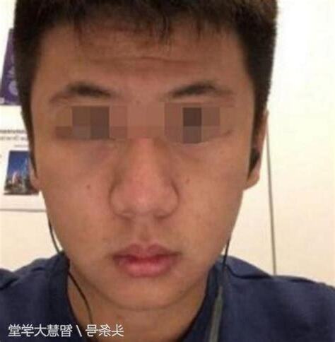 脖子長毛命理