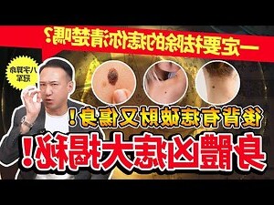 左後背有痣