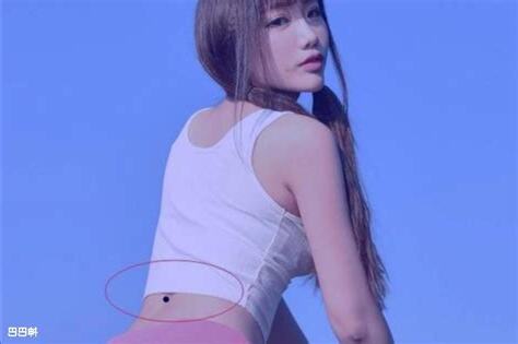 赤门痣