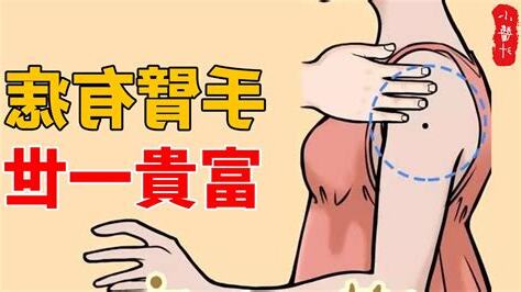 手臂有志