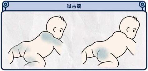 屁股黑青