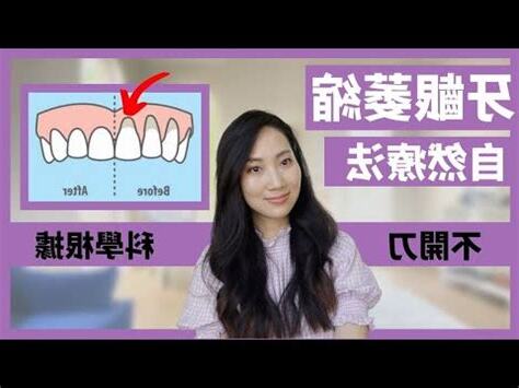 牙齒高低不平